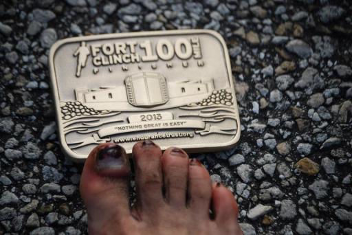 Krystle's beat up toes and a hard earned buckle!